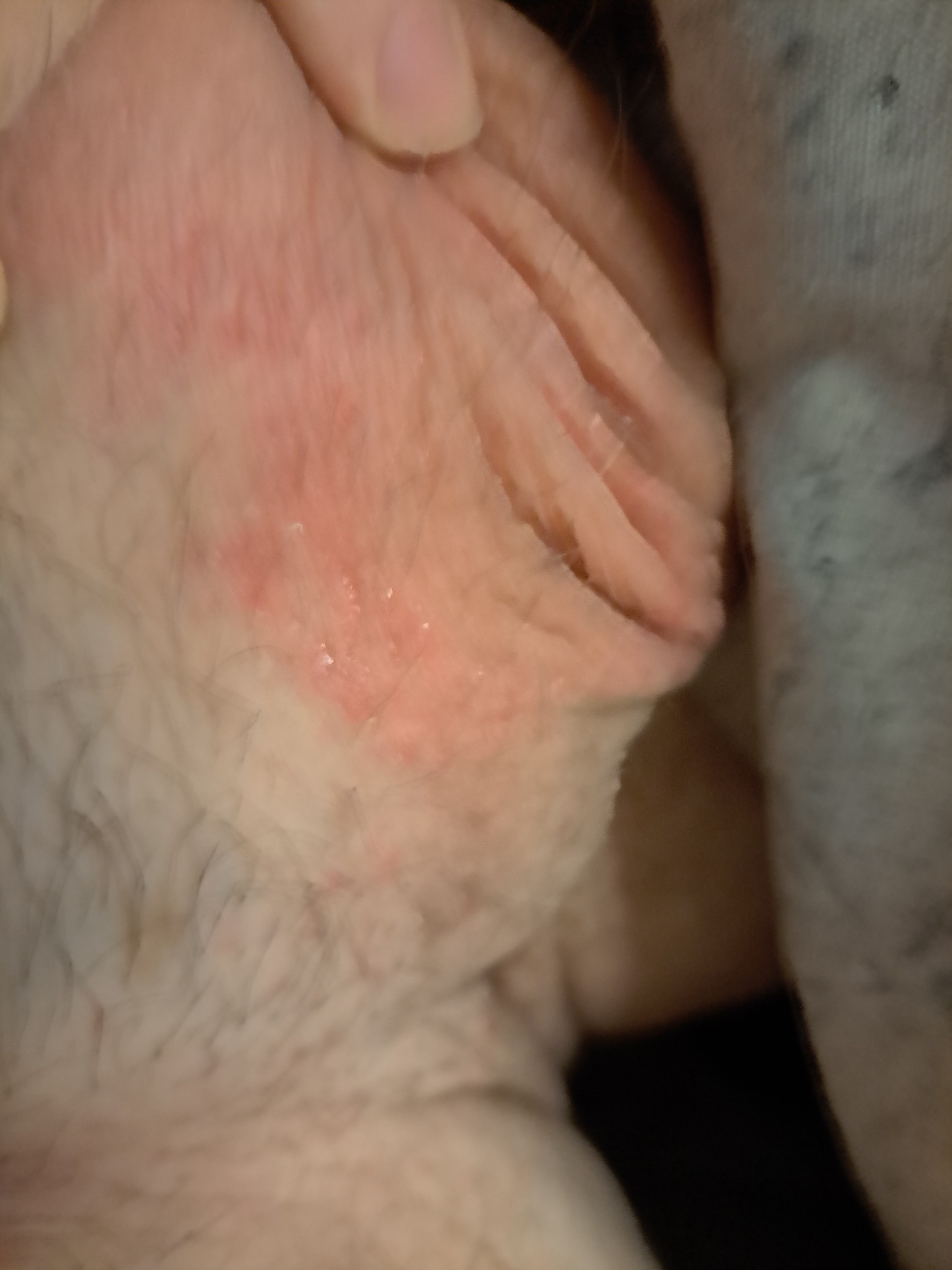 rash1.jpg