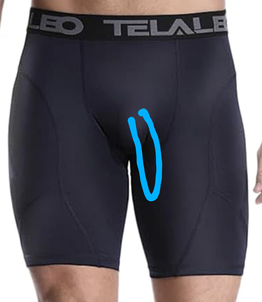 markup_1000013561.png