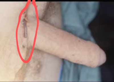 markup_1000013798.png