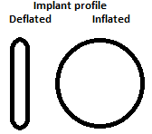Implant-profile.png