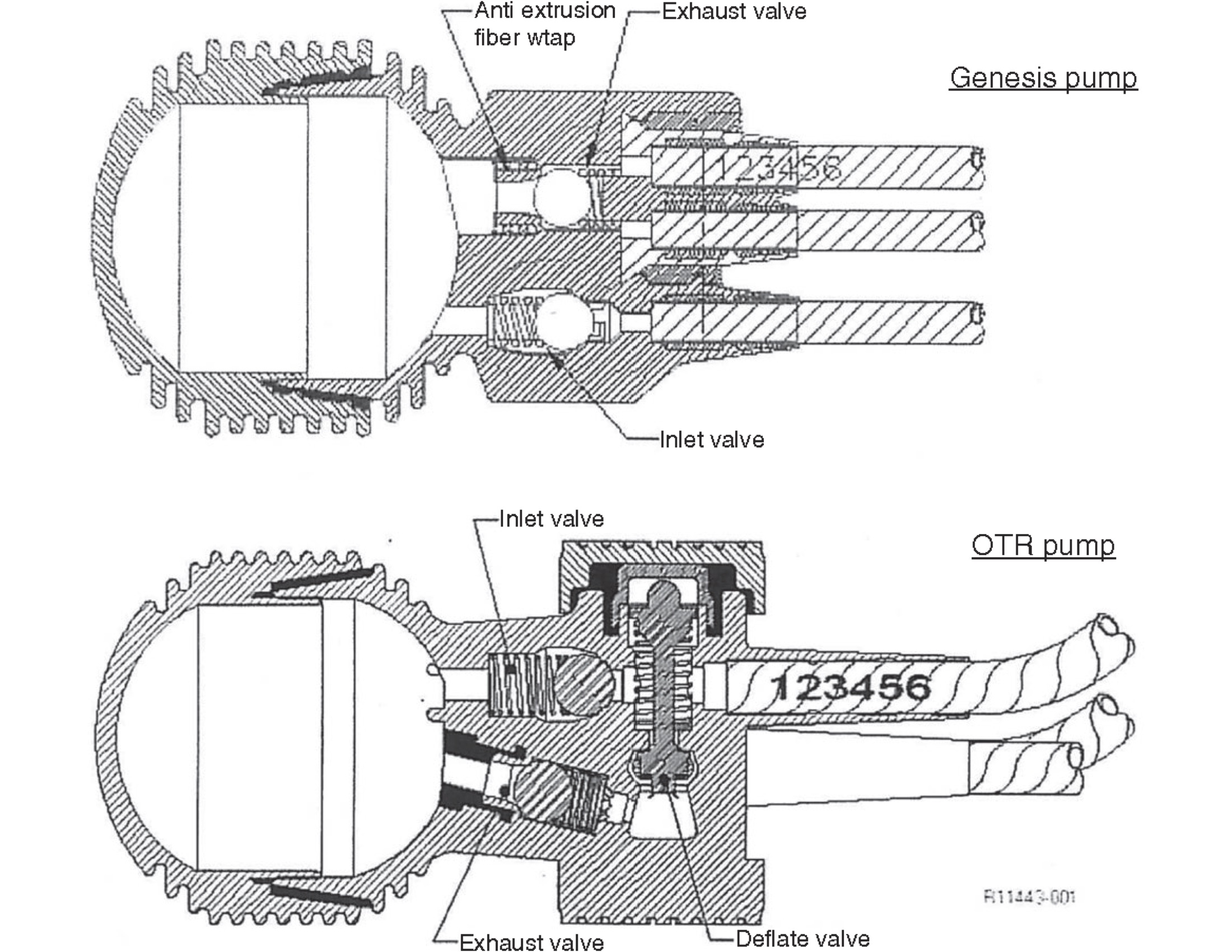 pump. schematic otr versus genesis coloplast.jpg